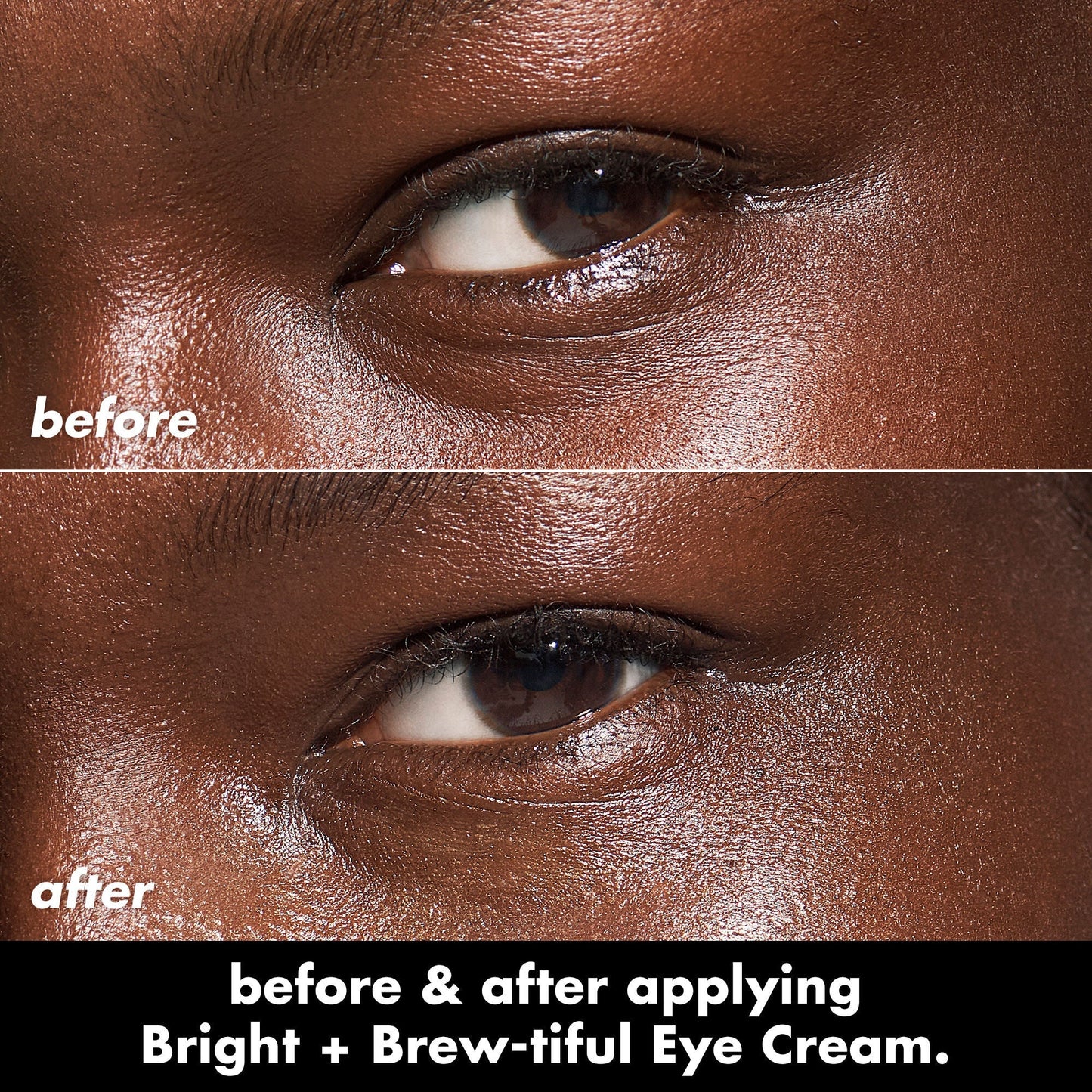bright-brew-tiful-eye-cream-e2 0226_BBEC_Eye_BA_Diptych_607e3ec2-f0e1-4365-9b28-17574d841250.jpg