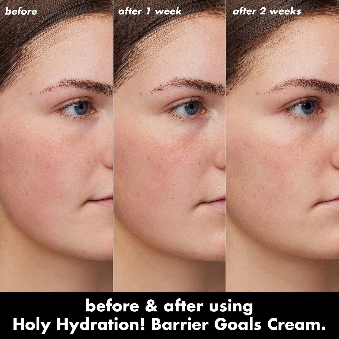 holy-hydration-barrier-goals-cream-mini-g1 0226_EDU_HHBarrierGoalsCream_B_A_Zoe_TRYPTICH_4f0e5b5d-35fb-4020-968e-244d4536afbd.jpg