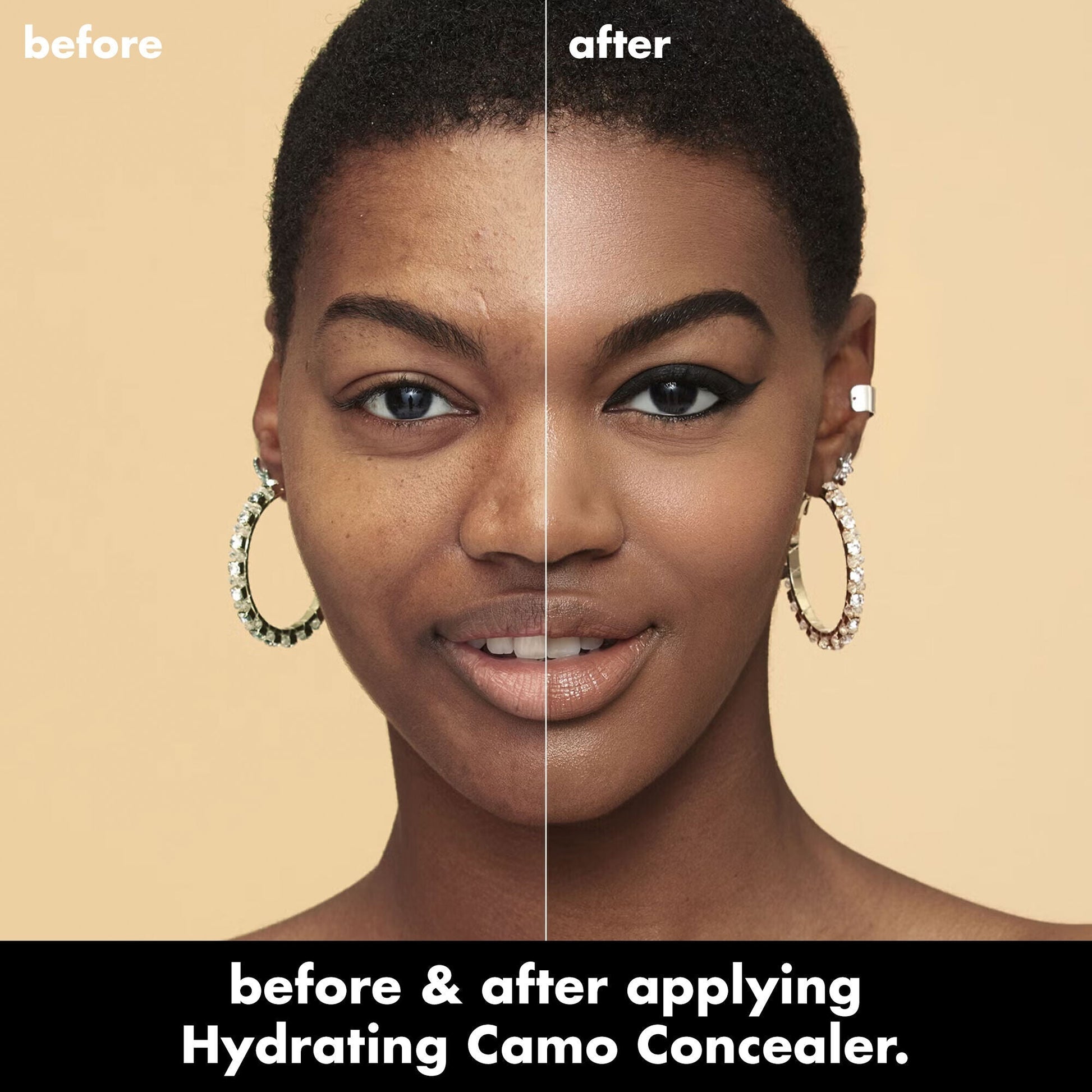 hydrating-camo-concealer-j5 0226_EDU_HydratingCamoConcelaer_BA_AshleyKaresh_20_1_d8499bbf-0e91-4173-b5e2-75127caf83a3.jpg