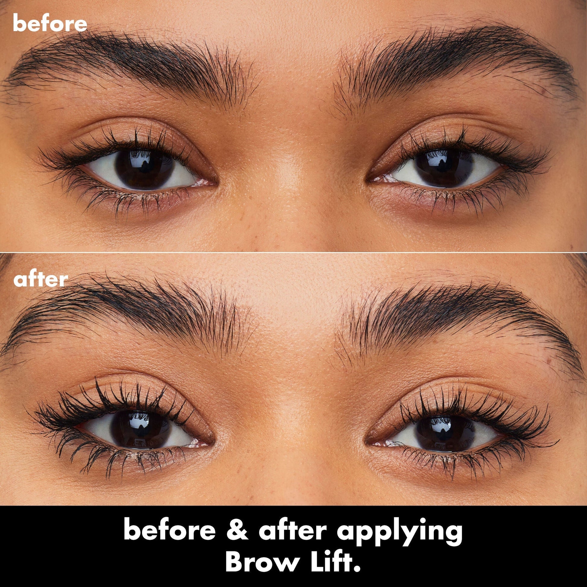 brow-lift-e0 0326_EDU_BrowLift_BA.jpg