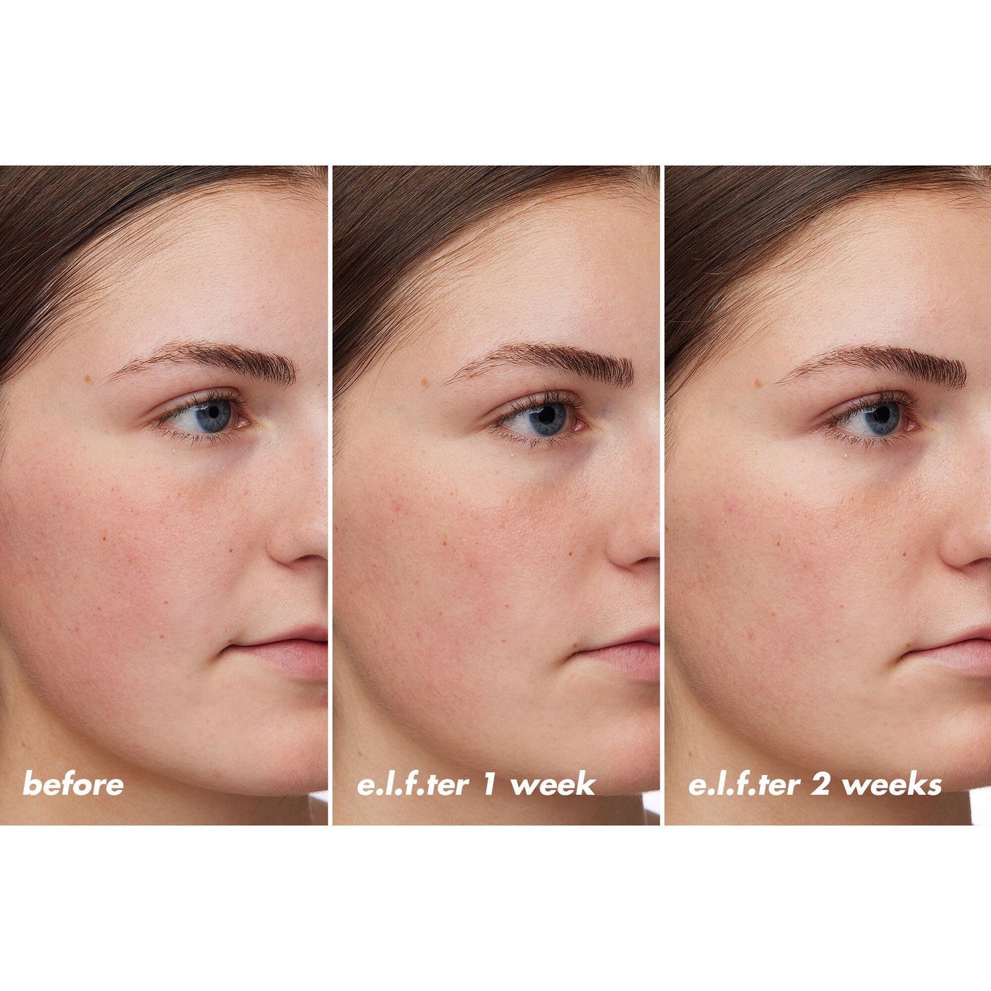 holy-hydration-barrier-goals-cream-regular-r7 XX26_EDUCATION_HH-BarrierGoals_B_A_Zoe_TRYPTICH_74c905bd-67bd-4b91-b633-2b01a8905cb8.jpg